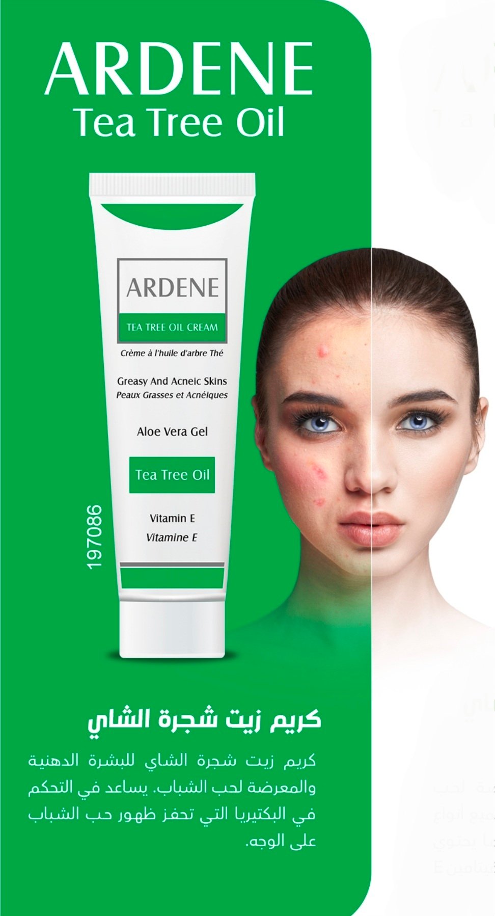 اردن مستخلص الشاي لحب الشباب 086