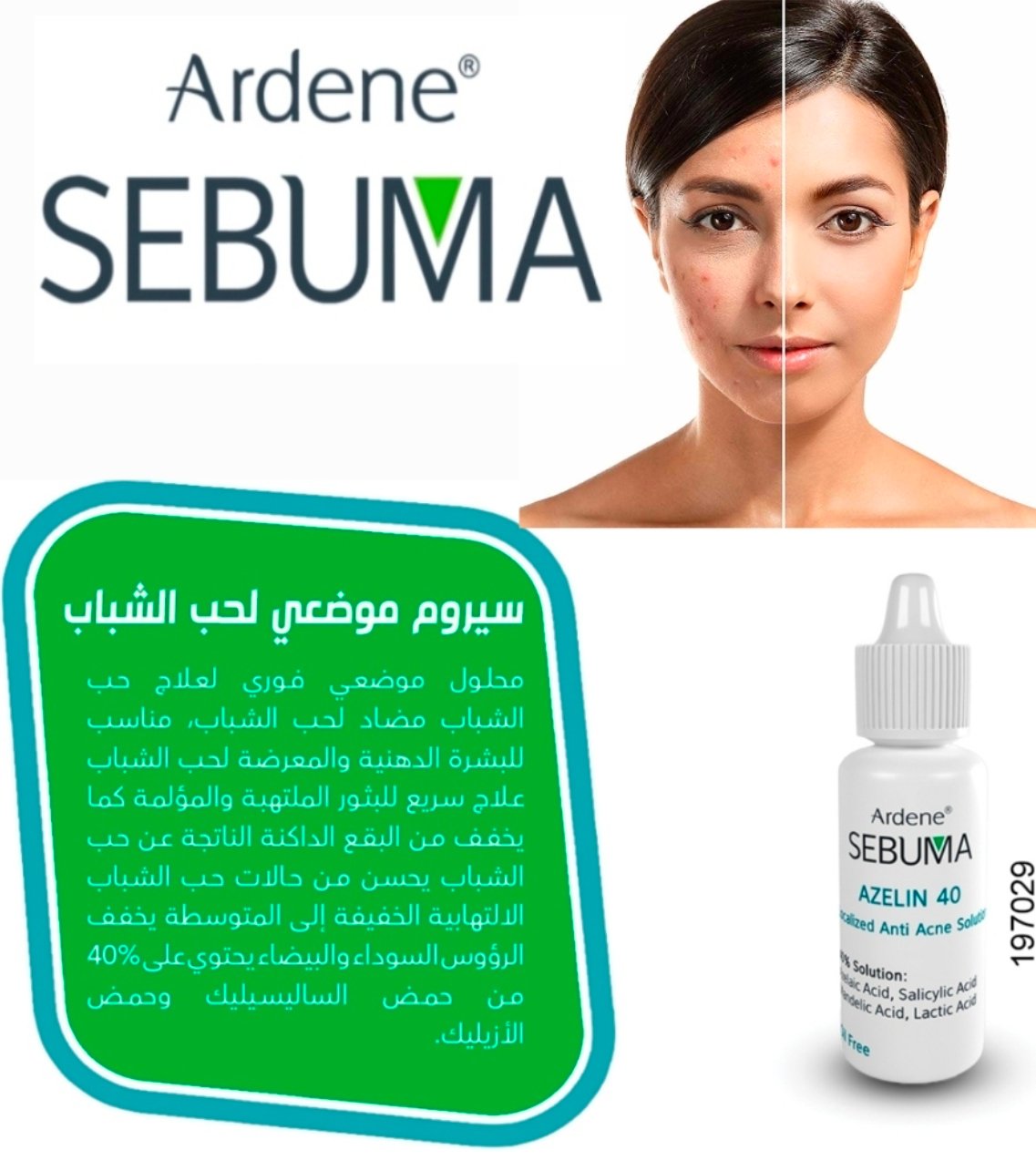 اردن سيبوما ازلين ٤٠ لعلاج حب الشباب 029
