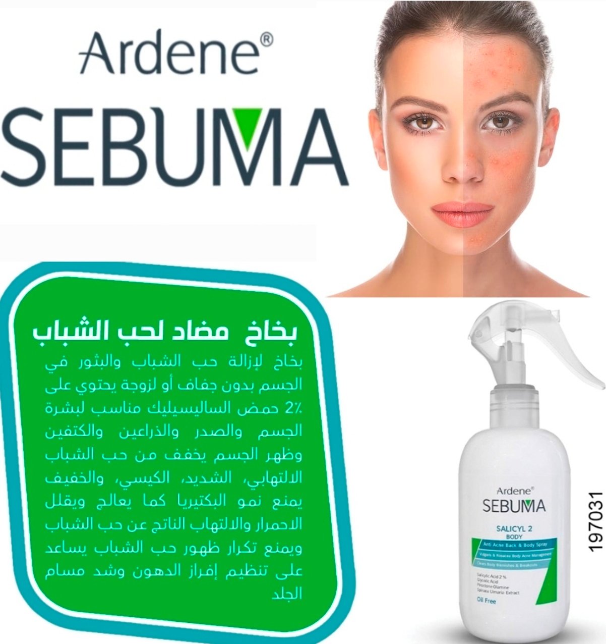 اردن سيبوما بخاخ لأزالة حب الشباب والبثور 031